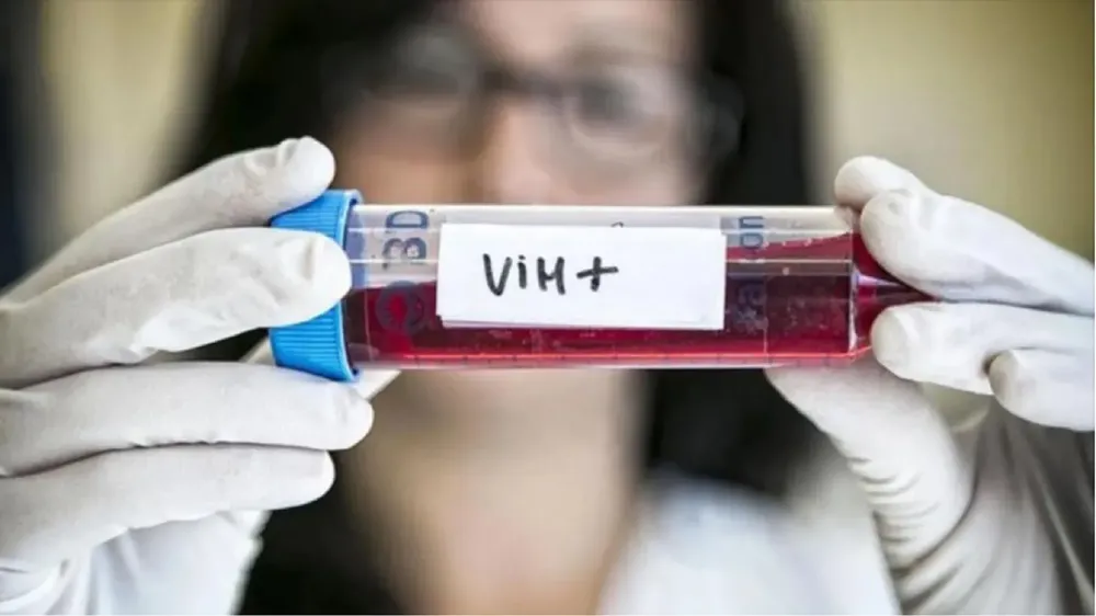 vih