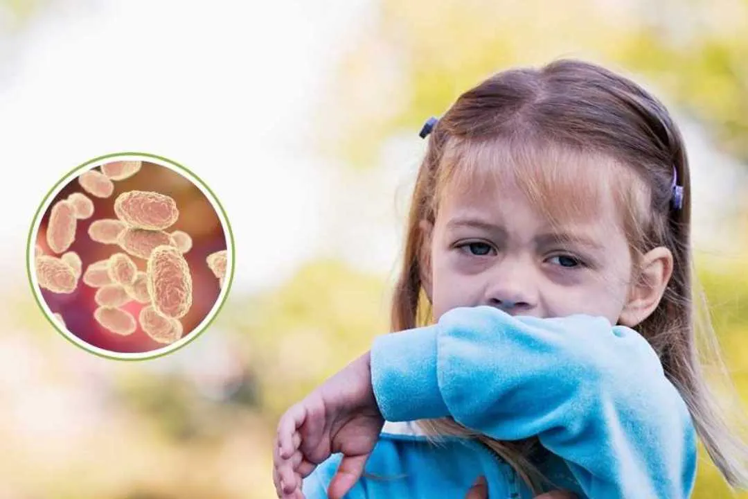 Alerta-por-coqueluche-¿Que-es-a-quienes-afecta-y-como-prevenir-esta-enfermedad-que-puede-ser-mortal